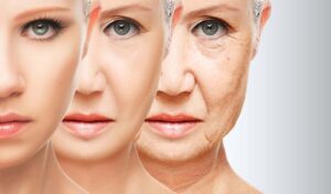 Regina Estética e Cabelo - Idade da pele