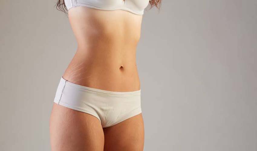 Regina Estética e Cabelo - Tratamento Estrias