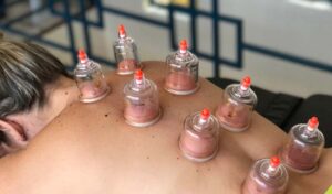 Regina Estética e Cabelo - Ventosaterapia